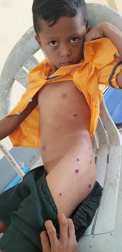 3 children, 2 women injured in Arakan artillery blast