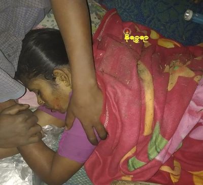 2 Muslim women died and 7 wounded in midnight artillery shall explosion in Buthidaung