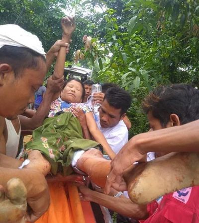Four injured in shelling of village in Kyauktaw, three transferred to Sittwe Hospital