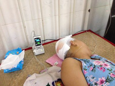 Explosion hit Rakhine woman remains unconscious for 10 days