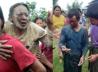 Injured farmer-couple in Rathedaung landmine explosion shifted to Sittwe