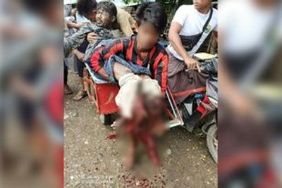   Landmine explosions seriously injure two Rakhine civilians in five days