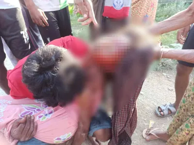 Marmagyi girl killed, 6 other children injured in artillery shell firing in Minbya