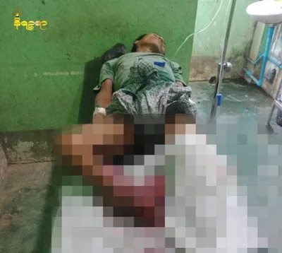 A landmine explosion in Minbya Township injured a man of Chin ethnicity