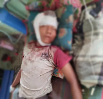 179 civilian-casualties reported in Rakhine State due to junta's attacks   