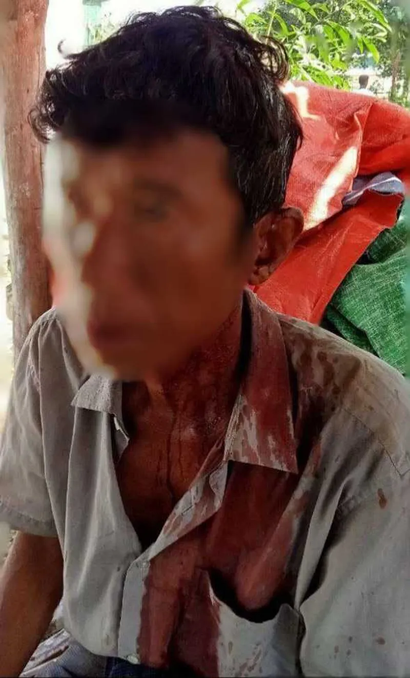 Ethnic villager in western Burma receives sword injury by miscreant