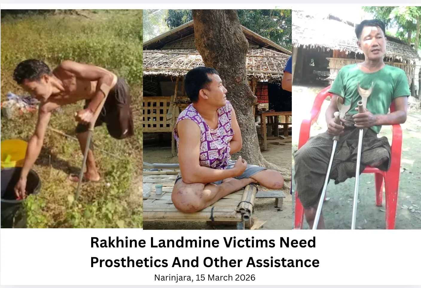 Rakhine landmine  victims need prosthetics and other assistance